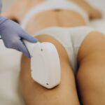 Laser epilation